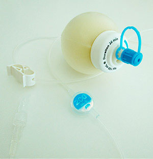 Infusionspumpen Elastomere Infusionspumpe